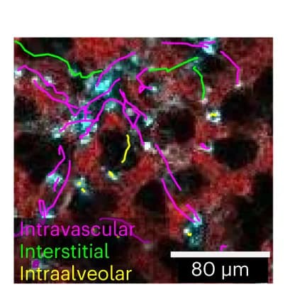 Open access visualization of Microscopy, Neutrophil Migration, Intra-alveolar Space, Interstitial Space, Intravascular Space