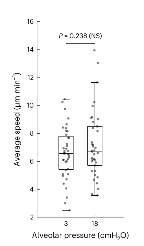Open access visualization of Box Plot, Scatter Plot, Neutrophil Speed, Pneumonia, Alveolar Pressure