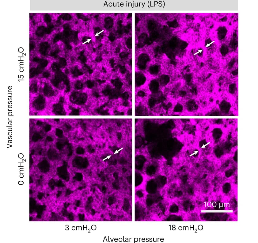 Open access visualization of Microscopy, Injured Lung, LPS, Capillaries, Inflammation
