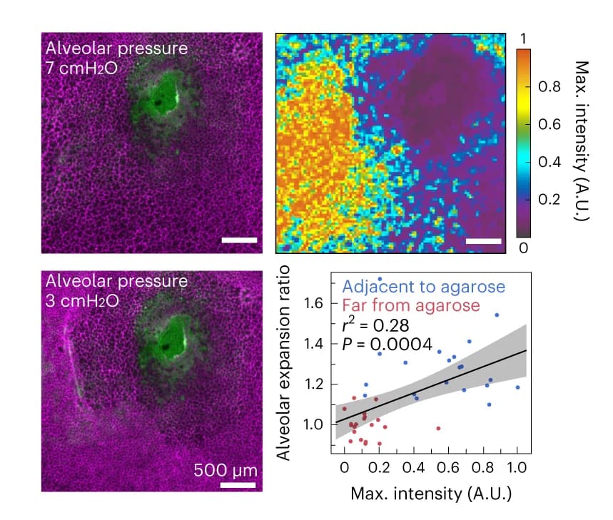 Open access visualization of Scatter Plot, Regression Plot, Microscopy, Evans Blue, Agarose
