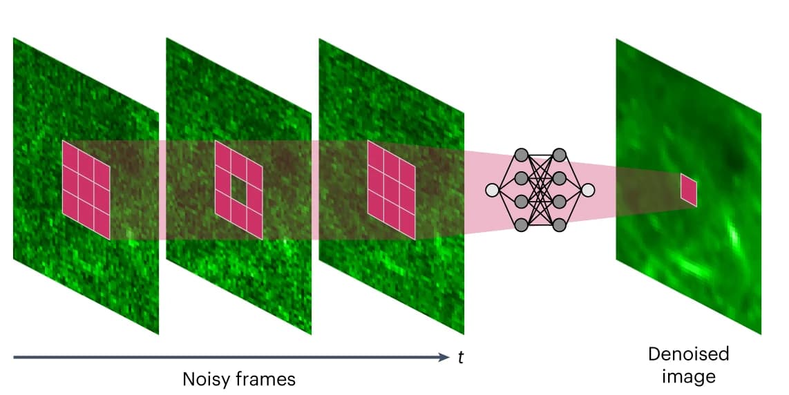 Open access visualization of Workflow, Illustration, SUPPORT Network, Denoising, Receptive Field
