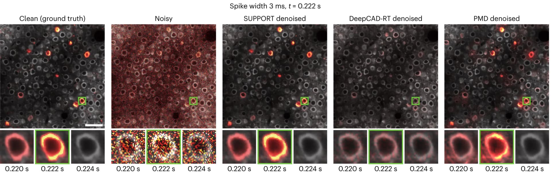 Open access visualization of Microscopy, Photo, Voltage Imaging, Denoising, Baseline