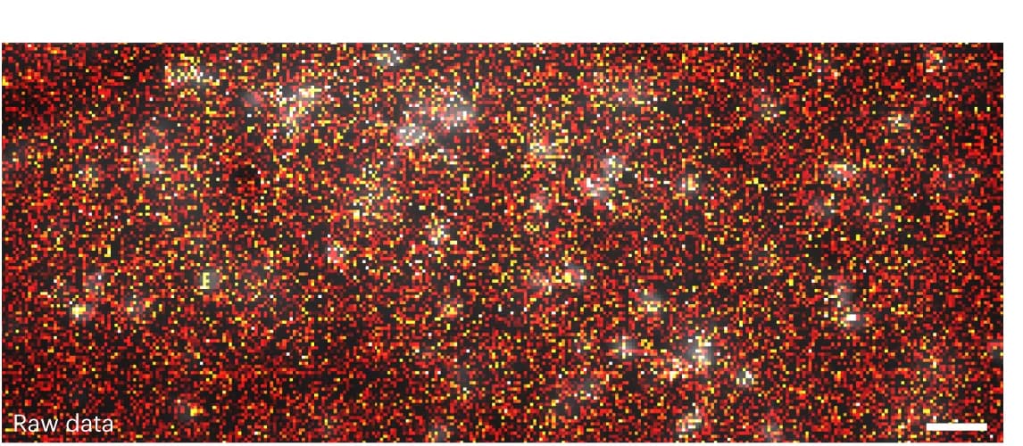 Open access visualization of Microscopy, Mouse, Raw Data, Denoised Data, ROI