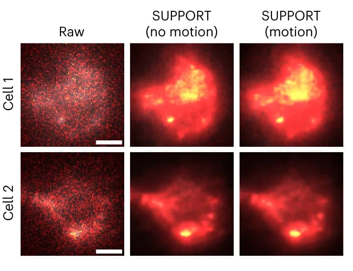 Open access visualization of Microscopy, Raw Video, SUPPORT-denoised Videos, Motion, Baseline Correction