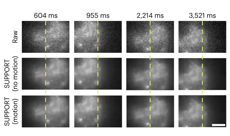 Open access visualization of Microscopy, Raw Video, SUPPORT-denoised Videos, Motion, Neurons