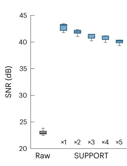 Open access visualization of Box Plot, Box-and-Whisker Plot, SNR, Ground-Truth Image, Motion