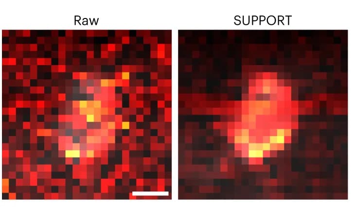 Open access visualization of Microscopy, Raw Video, SUPPORT-denoised Videos, Baseline Correction, Neuron