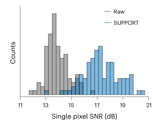 Open access visualization of Histogram, SNR, Raw Video, SUPPORT-denoised Video