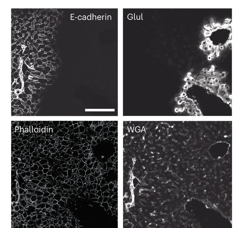 Open access visualization of Microscopy, Liver painting, E-cadherin, Glutamate-ammonia ligase, Phalloidin