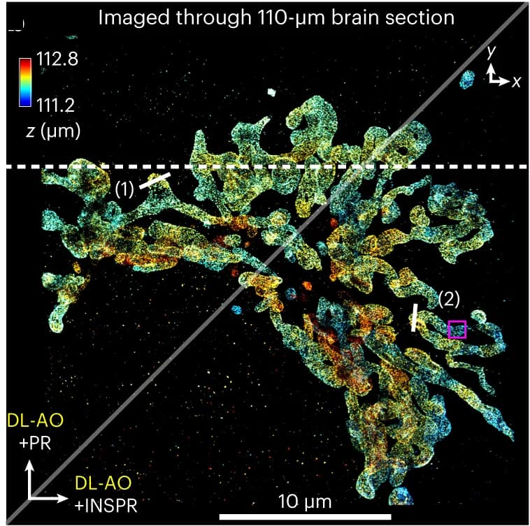 Open access visualization of Microscopy, Tom20 Proteins, Unlabeled Tissue, Adaptive Optics, PSF Model