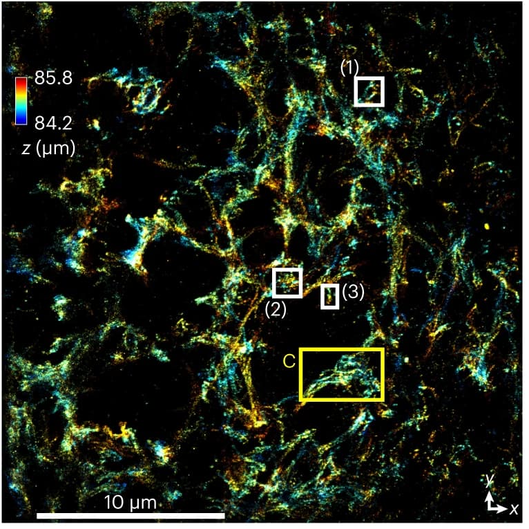 Open access visualization of Microscopy, Aβ Fibrils, SMLM, DL-AO, INSPR