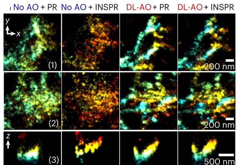 Open access visualization of Microscopy, Aβ Fibrils, DL-AO, PSF Model, INSPR