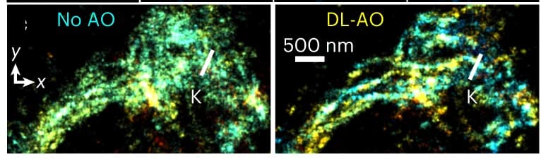 Open access visualization of Microscopy, Fibrils, AO, PR, INSPR
