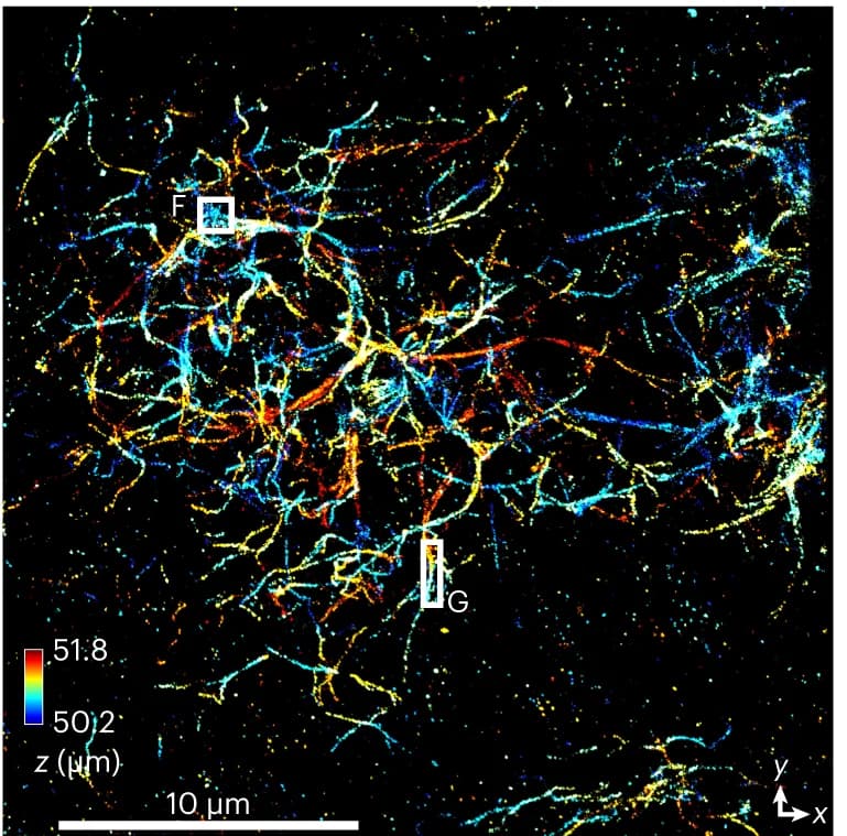 Open access visualization of Microscopy, Aβ Fibrils, DL-AO, INSPR