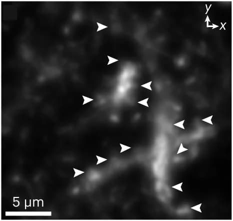 Open access visualization of Microscopy, Diffraction-limited images, Thy1-ChR2-EYFP