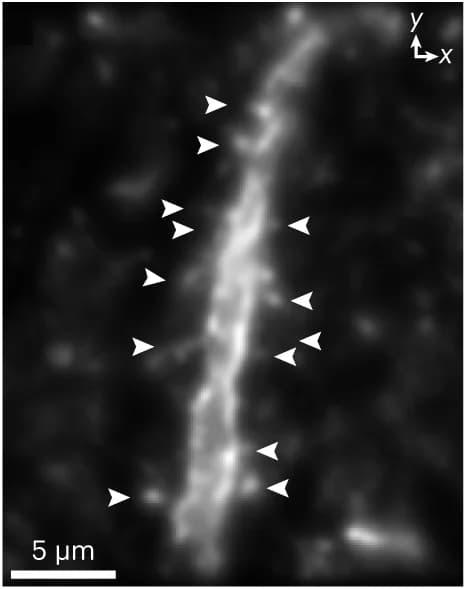 Open access visualization of Microscopy, Super-resolution reconstructions, Thy1-ChR2-EYFP, SMLM, DL-AO
