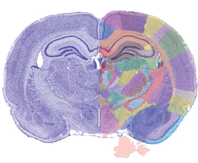 Open access visualization of Microscopy, Atlas Image, Histological Section, QuickNII Tool, Semitransparent