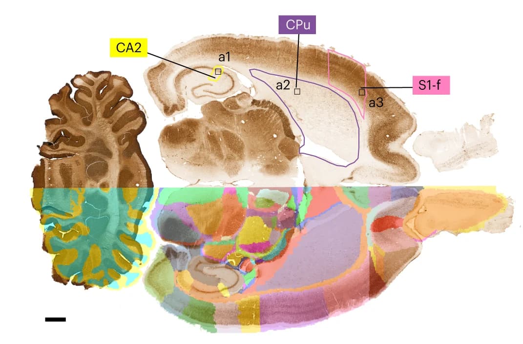 Open access visualization of Microscopy, Parvalbumin, WHS Rat Brain Atlas, Ilastik Software, Segmentation
