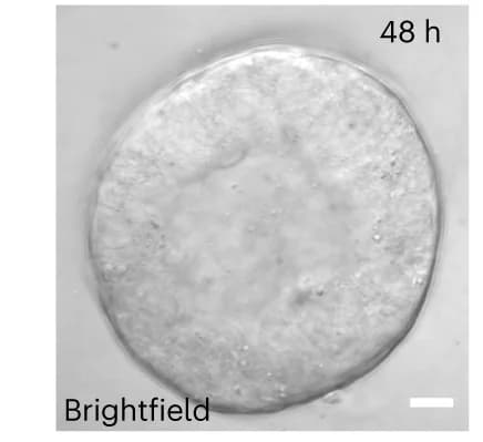 Open access visualization of Microscopy, Brightfield Image, Organoid, Mammary Epithelial Cells, Basement Membrane Matrix