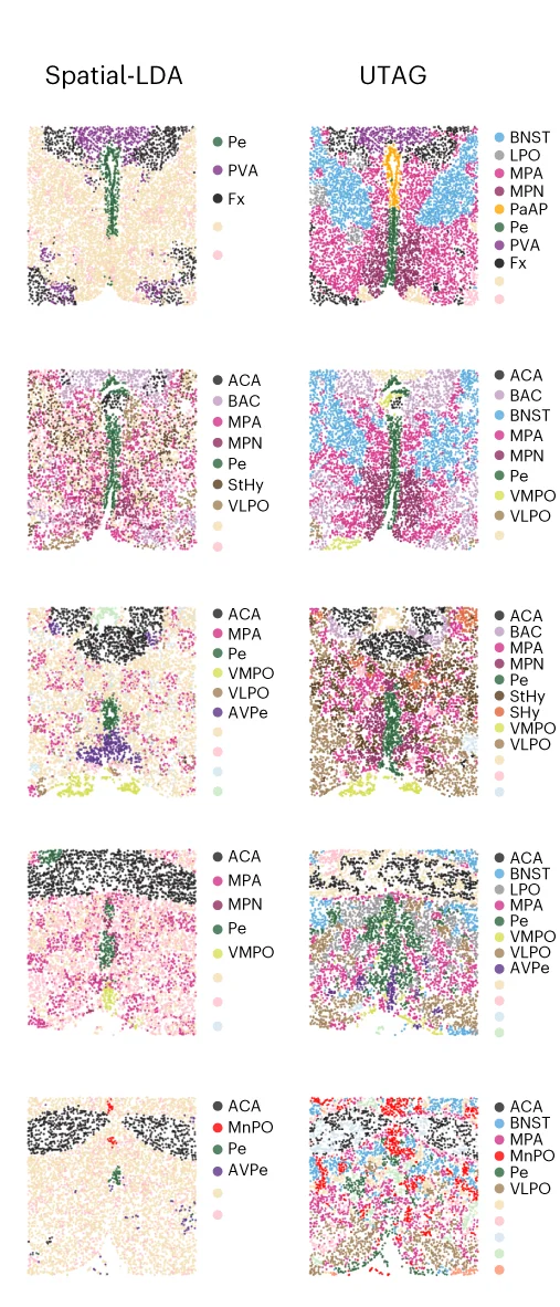 Open access visualization of Scatter Plot, TCNs, Spatial-LDA, UTAG, Manual Annotation