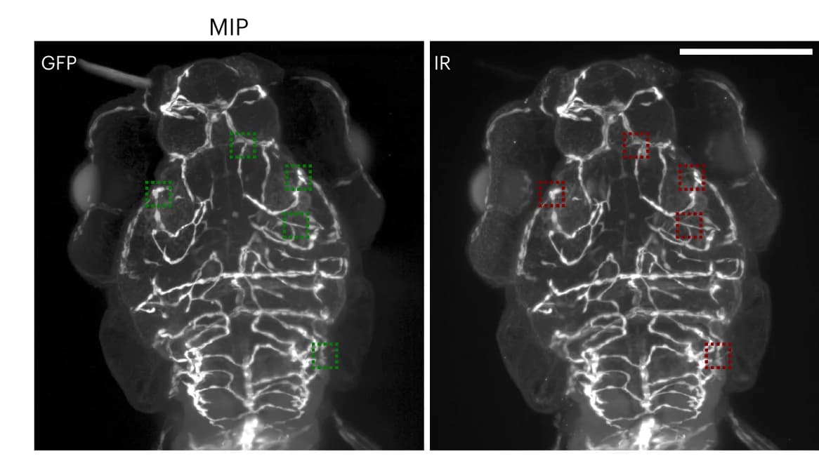 Open access visualization of Microscopy, Maximum Intensity Projection, Z Stacks, Zebrafish Larva, Vascular Marker