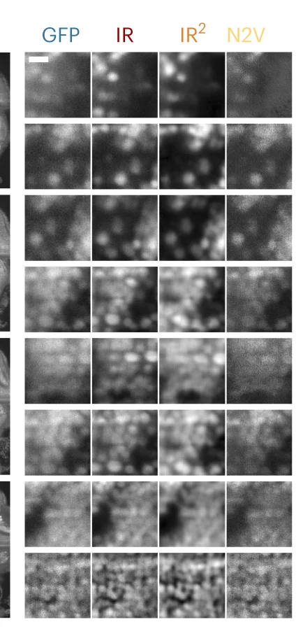 Open access visualization of Microscopy, Zebrafish Dataset, Cell Density, Patches
