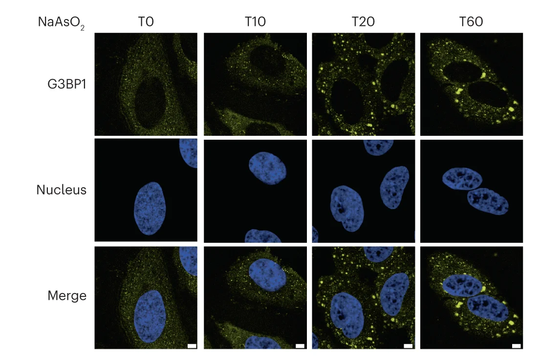 Open access visualization of Microscopy, Immunofluorescence Imaging, G3BP1, HeLa Cells, NaAsO2 Treatment