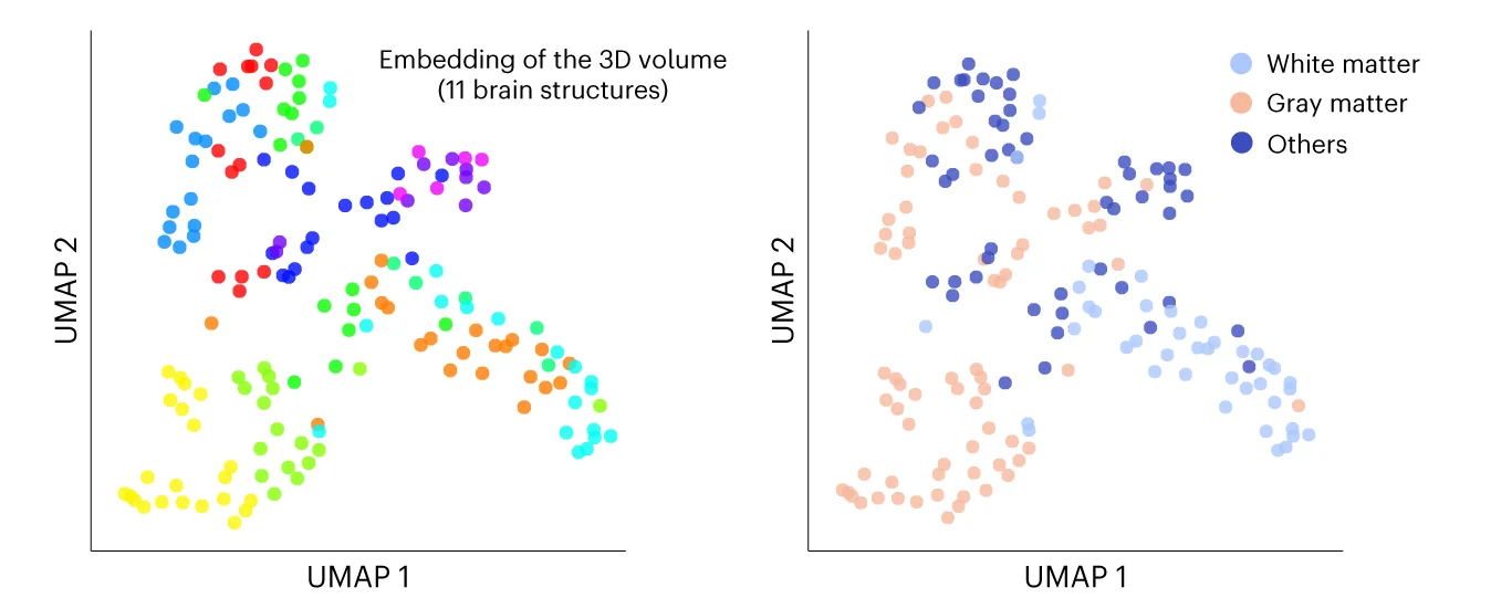 Open access visualization of Scatter Plot, UMAP, UMAP Analysis, Lipid Profiles, Brain Structures