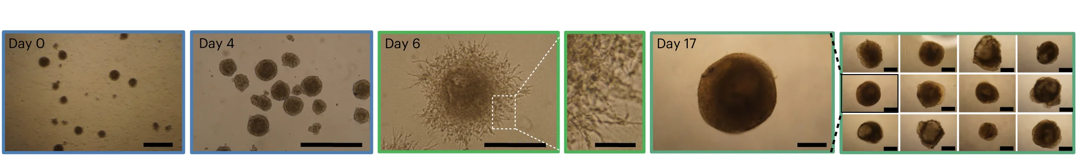 Open access visualization of Microscopy, Photo, Bright-field Images, iPSC1-derived Embryoid Bodies, Embryoid Bodies