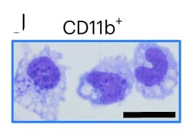 Open access visualization of Microscopy, Bright-field Microscopy, Cell Sorting, May-Gruenwald-Giemsa Staining, Myeloid Cells