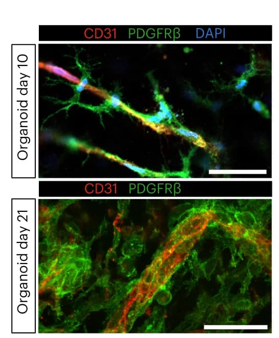 Open access visualization of Microscopy, Pericyte EC Association, Confocal Microscopy, Differentiation, PDGFRbeta
