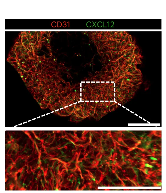 Open access visualization of Microscopy, CXCL12 Expression, Cell Subsets, Organoid, Confocal Microscopy