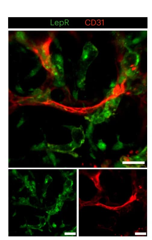 Open access visualization of Microscopy, LepR Expression, Confocal Microscopy