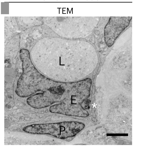 Open access visualization of Microscopy, TEM Analysis, Organoid Section, Capillary-like Structure, EC