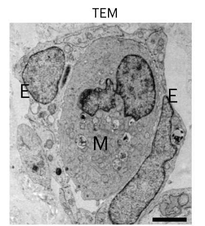 Open access visualization of Microscopy, TEM Analysis, Organoid Section, ECs, Myeloid Cells