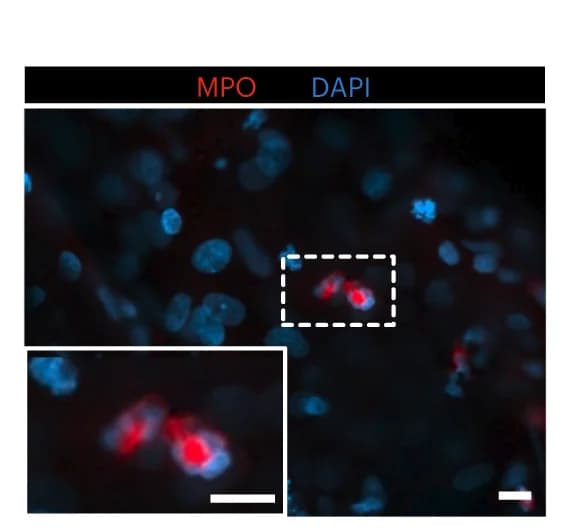 Open access visualization of Microscopy, Confocal Imaging, Immunostaining, MPO, Banded Nucleus