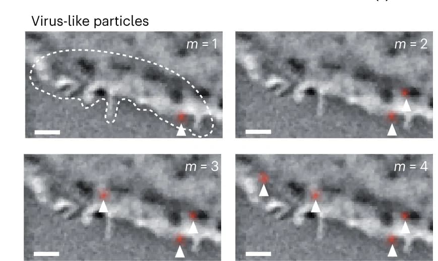Open access visualization of Microscopy, Virus-Like Particles, Confocal iSCAT