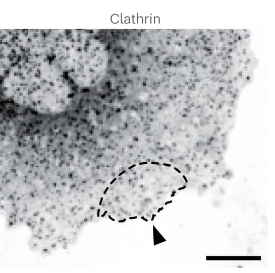 Open access visualization of Microscopy, Fluorescence Image, Clathrin, HaloTag-OregonGreen