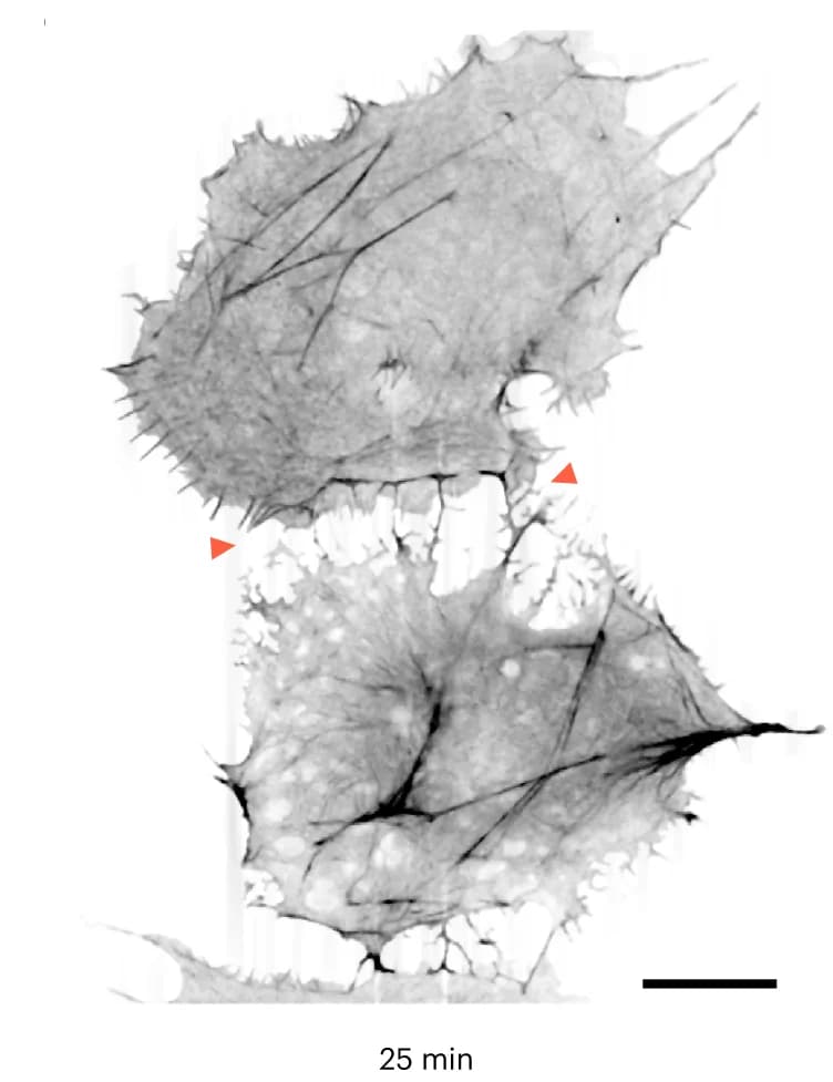 Open access visualization of Microscopy, Photo, Cells, Lat-A Treatment, Cell-Cell Boundary