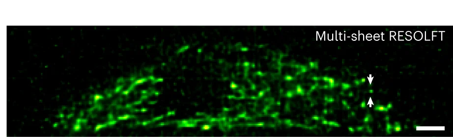 Open access visualization of Microscopy, Axial Slice, Volumetric Rendering, RESOLFT, Deconvolution