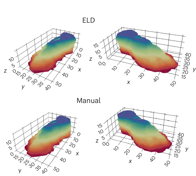 Open access visualization of 3D Plot, ELD, Registration, Manual Annotation, Prostate Samples