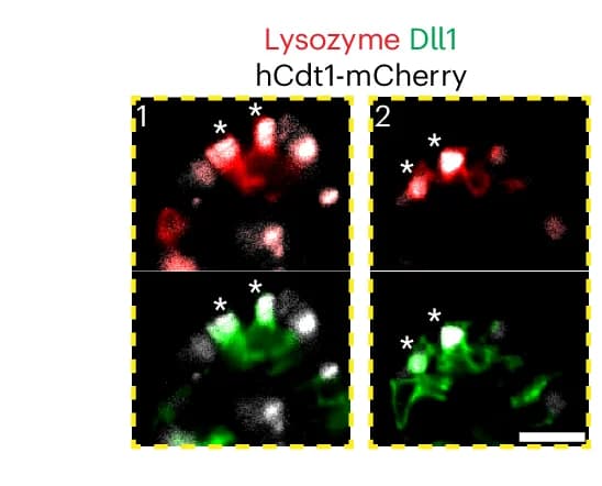 Open access visualization of Microscopy, Intestinal Crypts, hCdt1, DLL1, Lysozyme