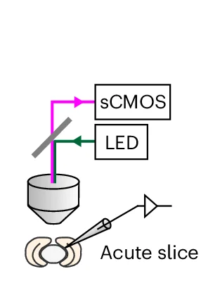 Open access visualization of Workflow, Illustration, Calcium Imaging, Patch-Clamp Recording, Brain Slices