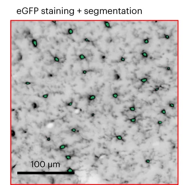 Open access visualization of Microscopy, Cortex, Segmented Cells, DELiVR Analysis, Brain Hemisphere