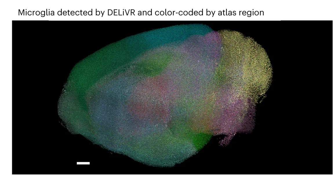 Open access visualization of Microscopy, Microglia, Brain Hemisphere, DELiVR, Imaris
