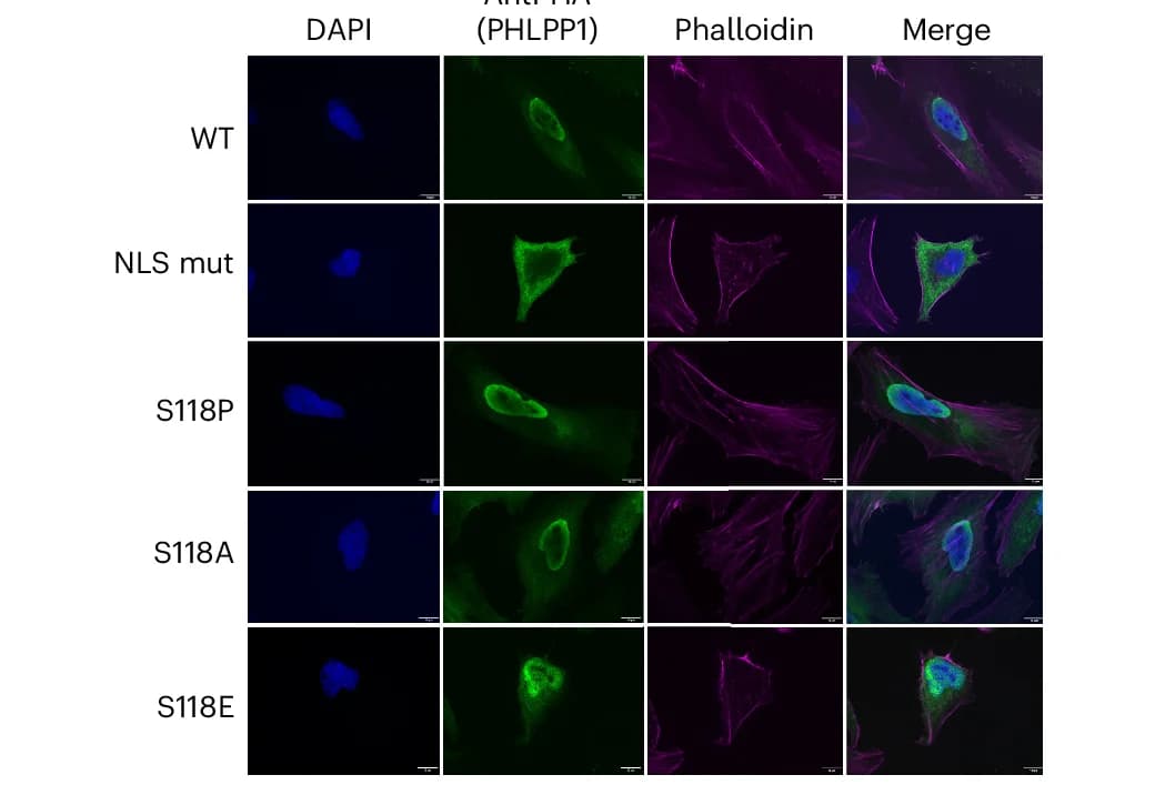 Open access visualization of Microscopy, Spinning disk confocal microscopy, Subcellular localization, PHLPP1 NTE constructs, Nuclear localization sequences