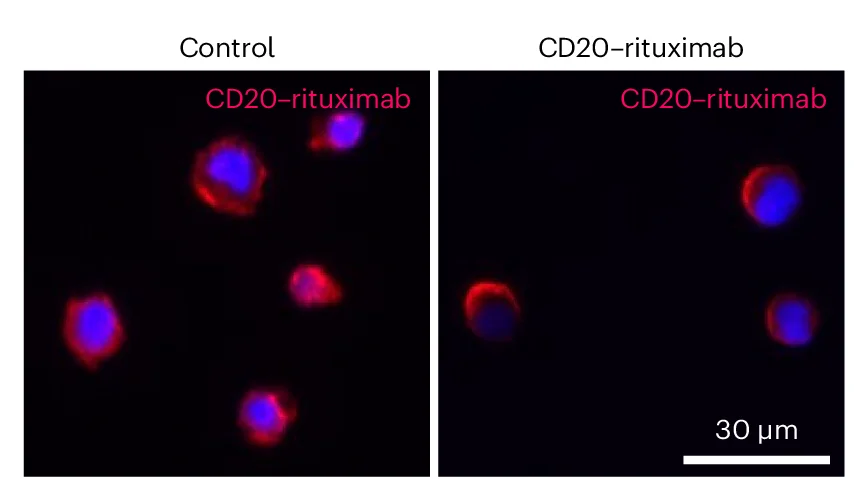 Open access visualization of Microscopy, Fluorescence Microscopy, Validation, Rituximab-Treated, Control Samples