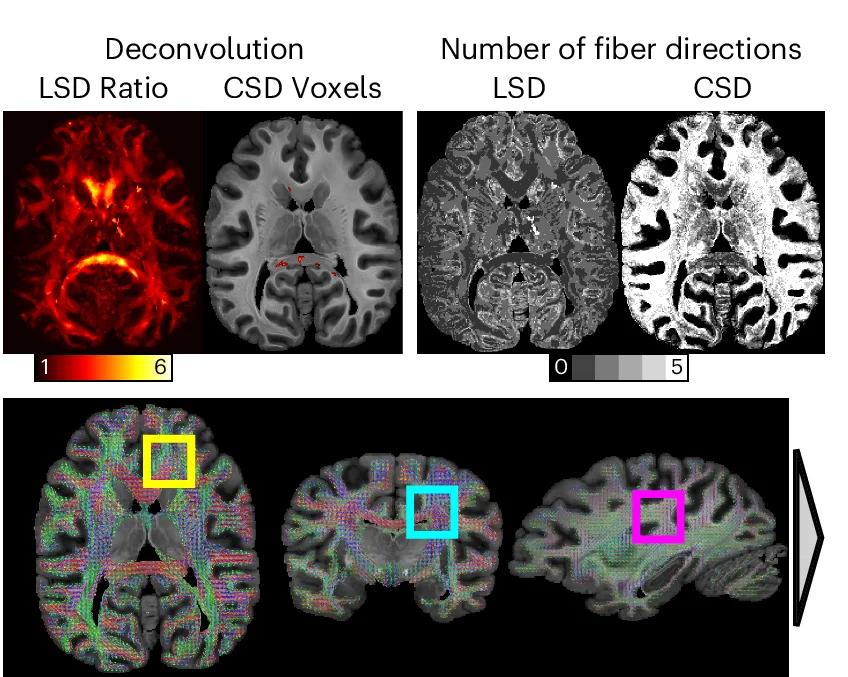 Open access visualization of Microscopy, LSD, CSD, Reconstruction, Deconvolution
