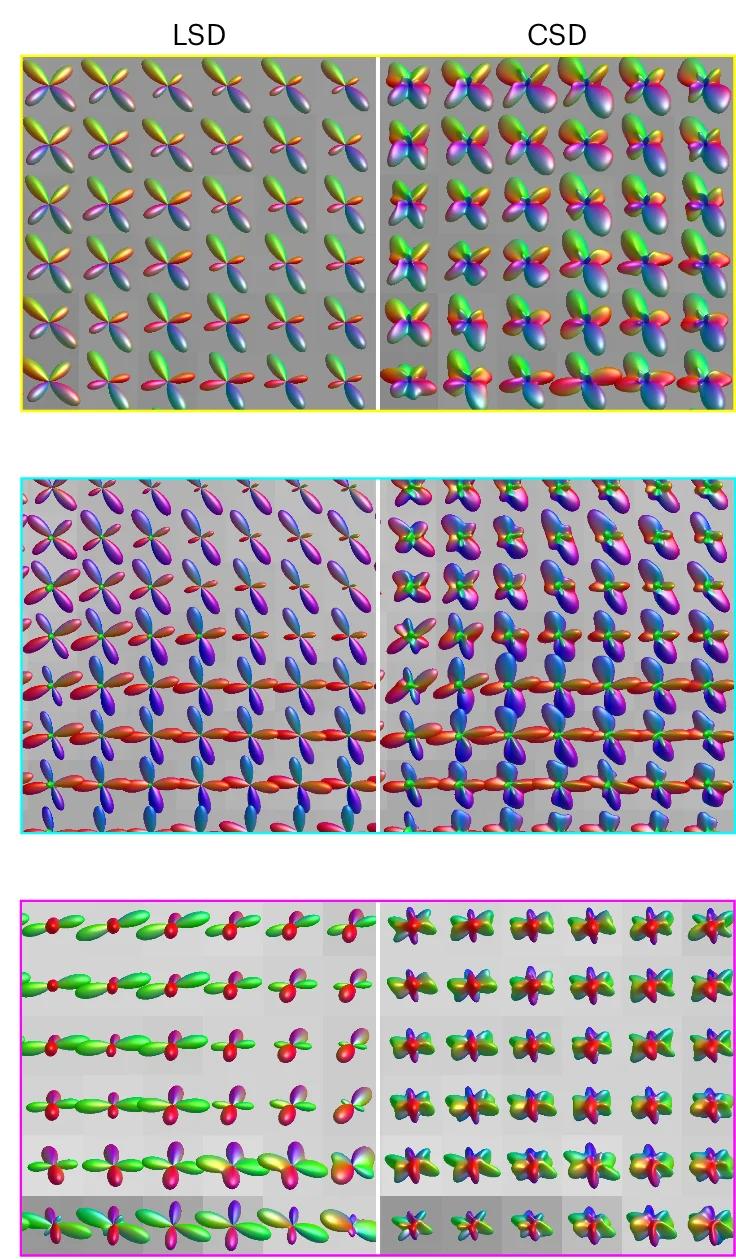 Open access visualization of 3D Plot, LSD, CSD, fODFs, Brain Regions