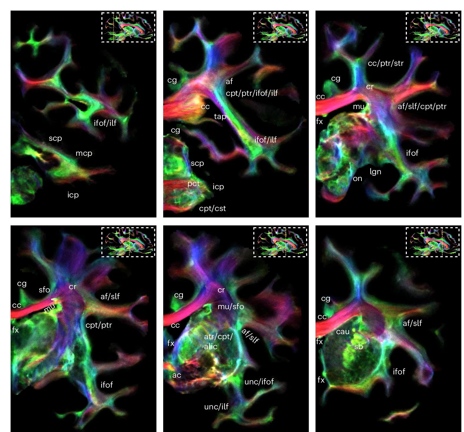 Open access visualization of Microscopy, Coronal Slices, Track-Density Data, Anatomical Labels, Left Hemisphere